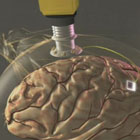BrainGate Neural Interface System